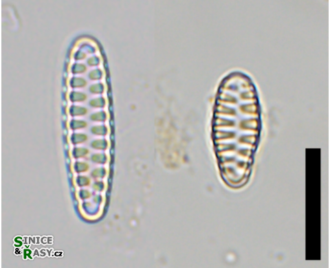 Staurosirella pinnata