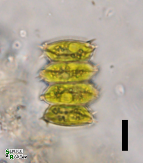 Scenedesmus striatus