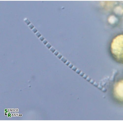 Pseudanabaena galeata