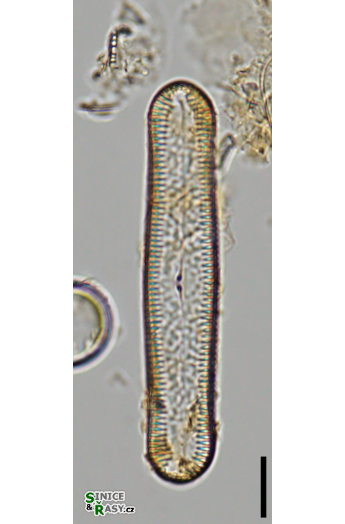 Pinnularia acrosphaeria