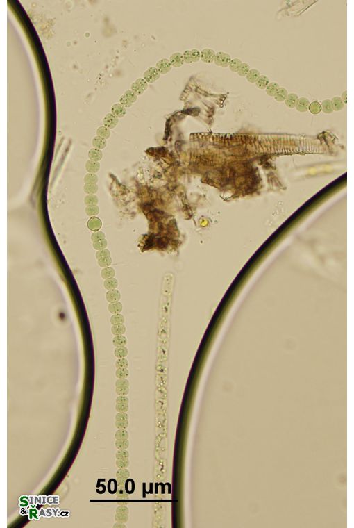 Anabaena lapponica