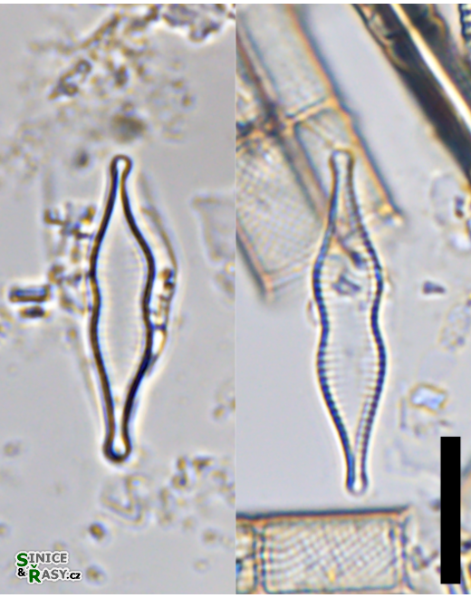 Pseudostaurosira subconstricta
