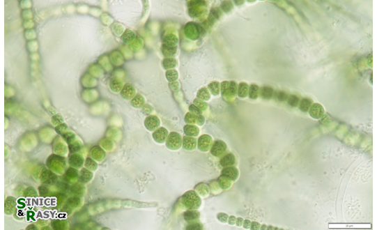 Mastigocladus laminosus