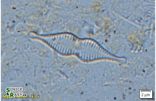 Pseudostaurosira parasitica