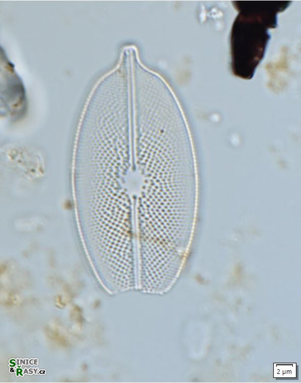 Decussiphycus placenta