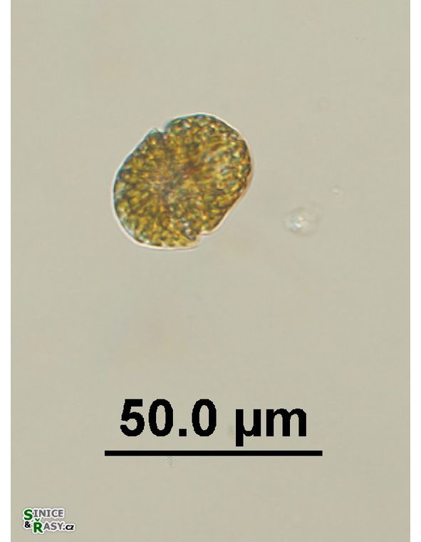 Gyrodinium sp. 