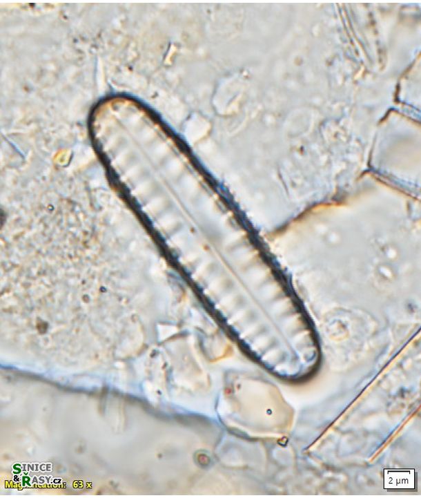 Pinnularia borealis