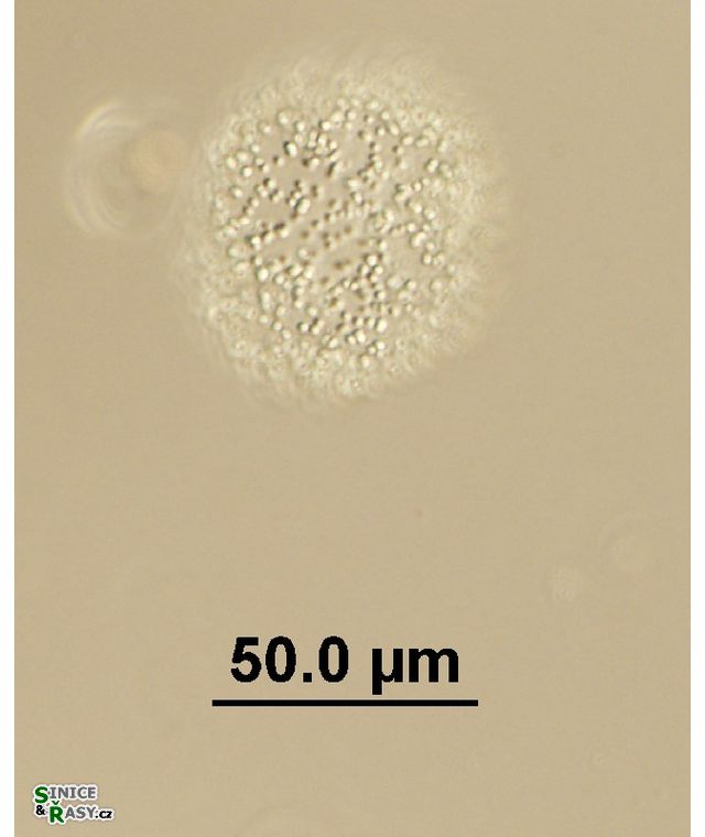 Aphanocapsa planctonica