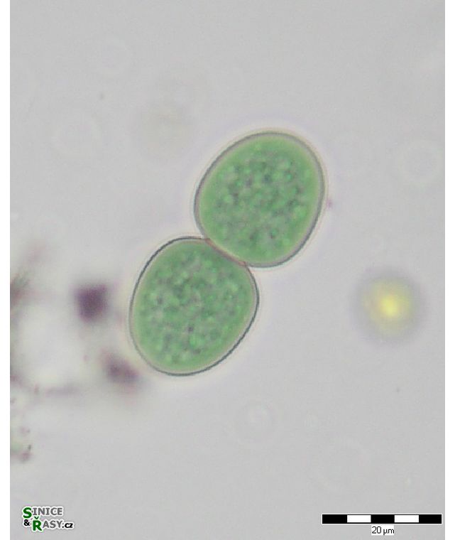 Cyanothece aeruginosa