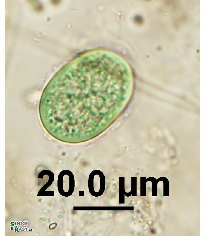 Cyanothece aeruginosa