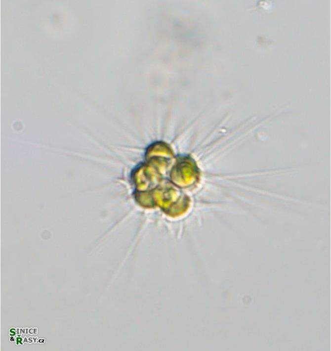 Micractinium pusilum