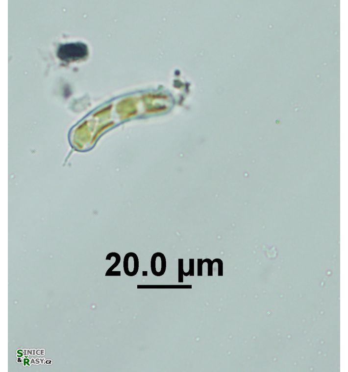 Ophiocytium cochleare