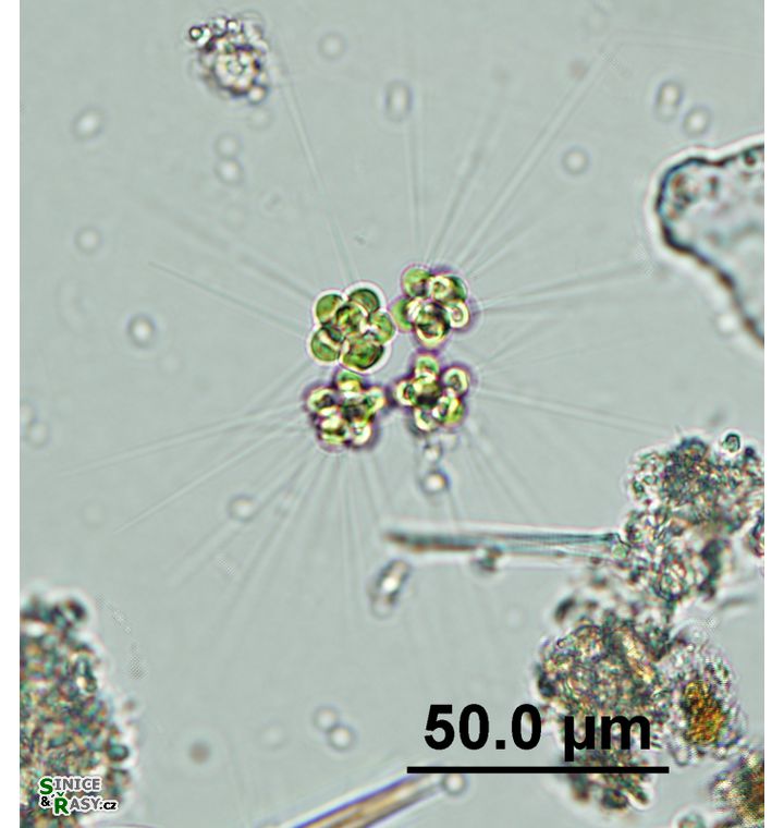 Micractinium pusilum