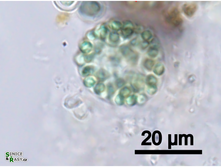 Coelosphaerium kuetzingianum