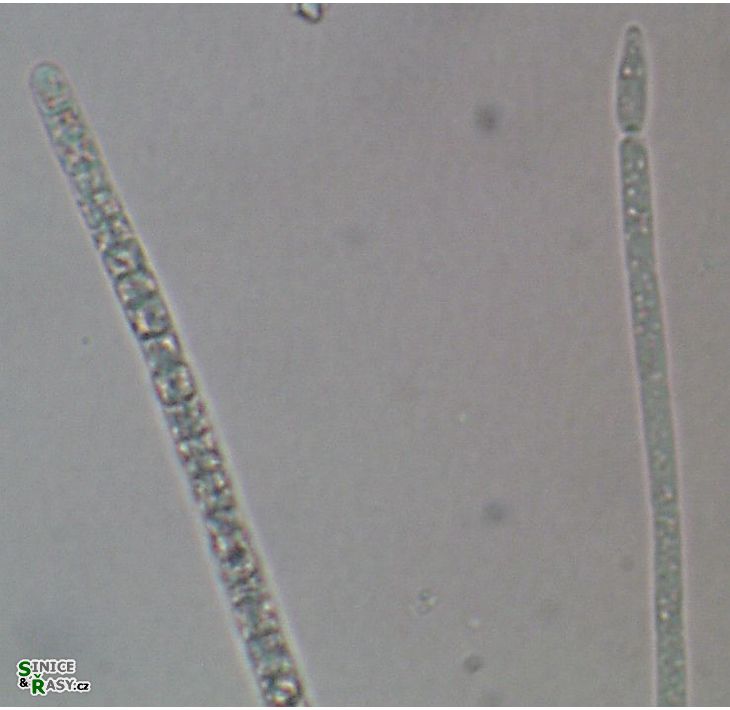 Raphidiopsis raciborskii