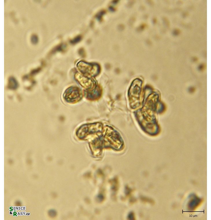 Dimorphococcopsis