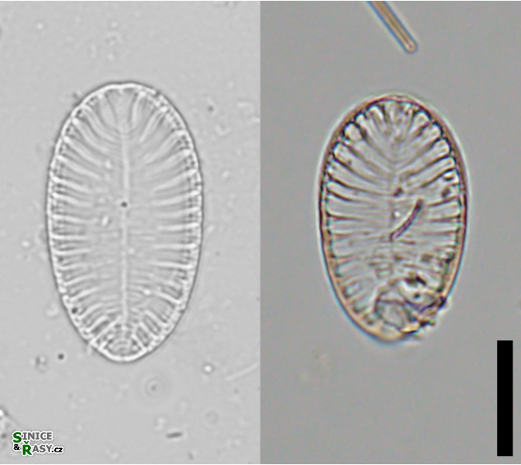 Surirella brebissonii