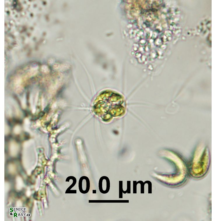 Lagerheimia ciliata