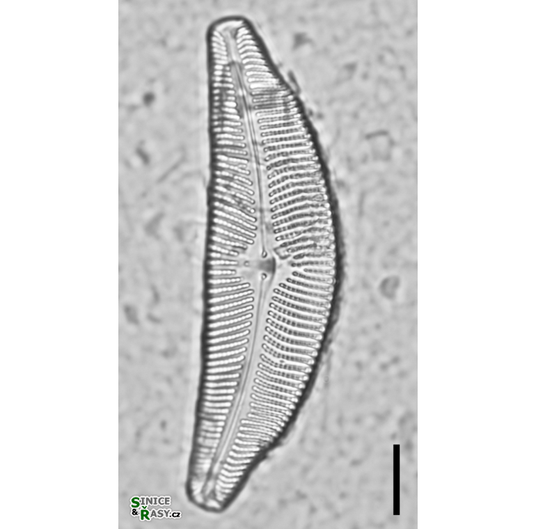 Cymbella tumida