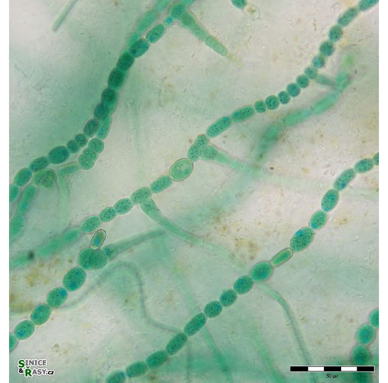 Mastigocladus laminosus