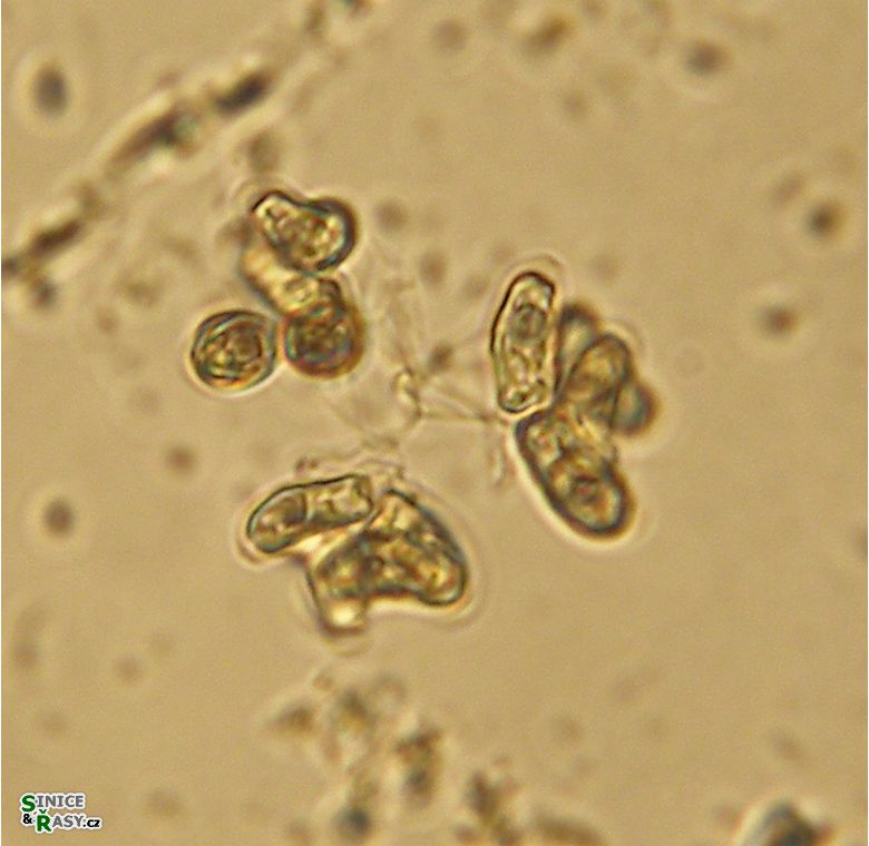 Dimorphococcopsis