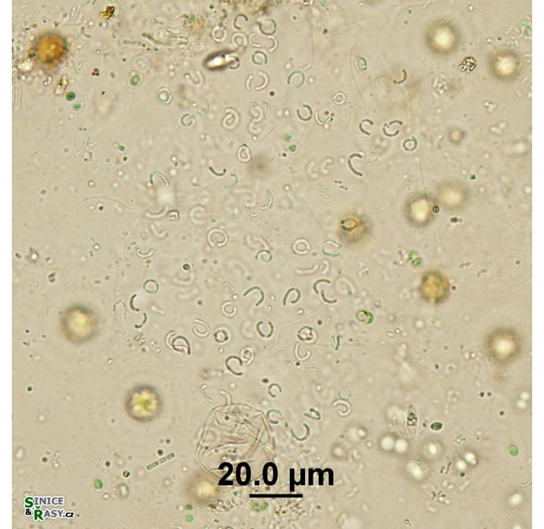 Rhabdoderma vermiculare