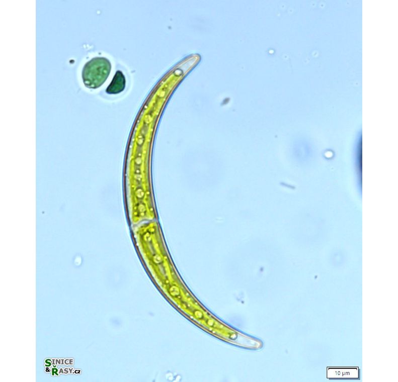 Closterium calosporum