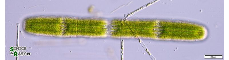 Penium margaritaceum