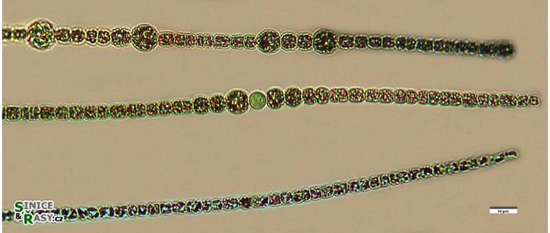 Sphaerospermopsis aphanizomenoides
