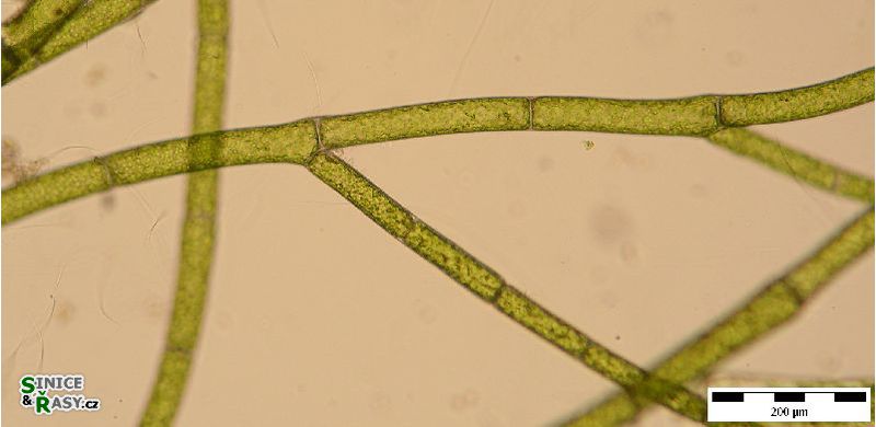Cladophora globulina 