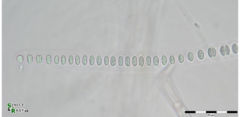 Johanesbaptistia pellucida