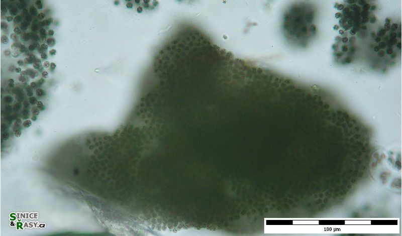 Microcystis ichtyoblabe 