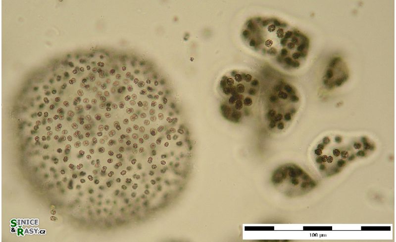 Microcystis flos-aquae (+ M. wesenbergii)