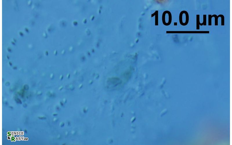 Lithococcus ramosus