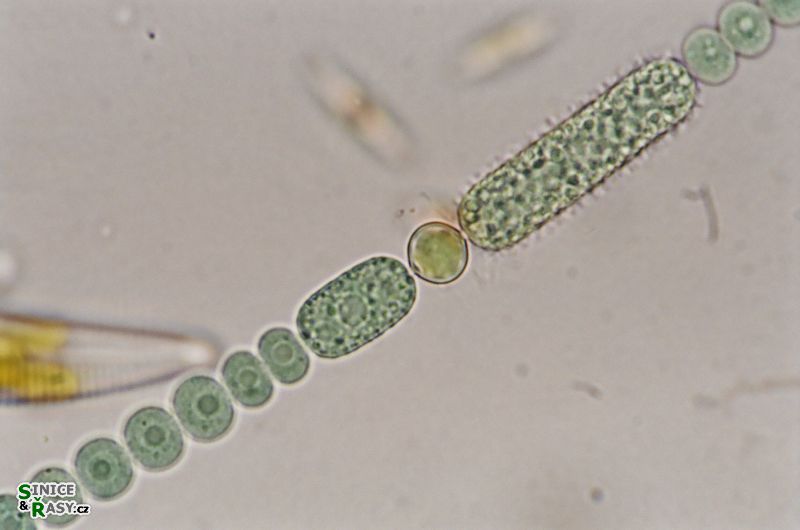 Anabaena echinospora