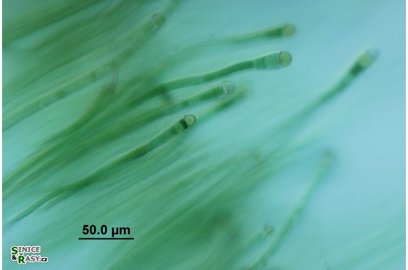 Rivularia mesenterica