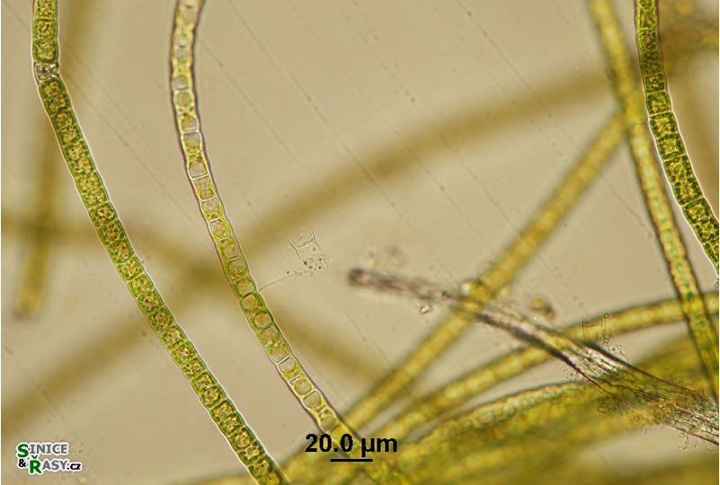 Microspora sp. 