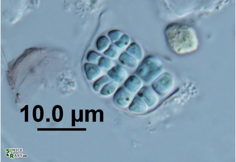 Cyanosarcina thalassia