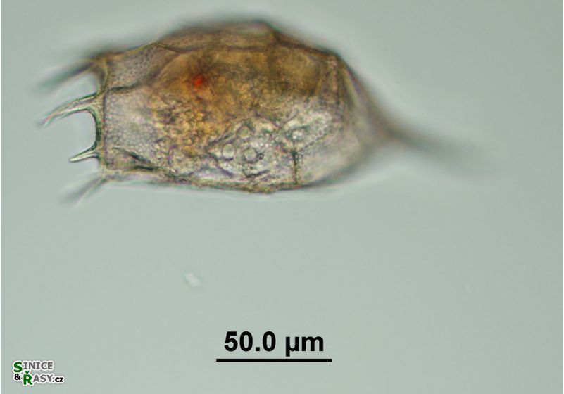 Keratella cochlearis