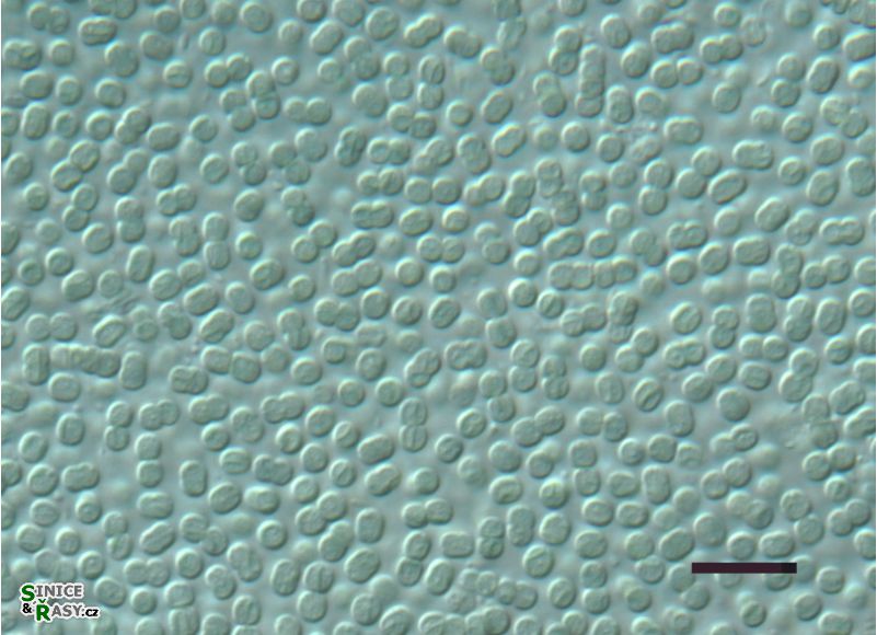 Cyanobacterium