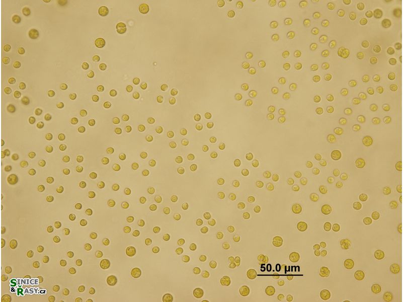Tetraspora gelatinosa