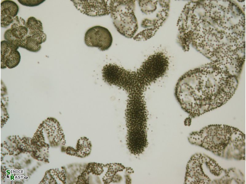 Microcystis spp.
