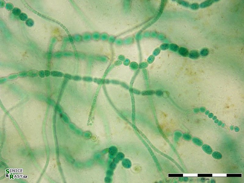 Mastigocladus laminosus