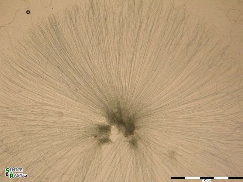 Nostochopsis lobatus