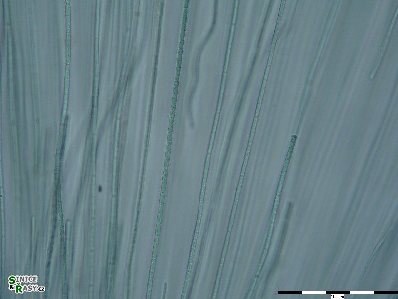 Nostochopsis lobatus 