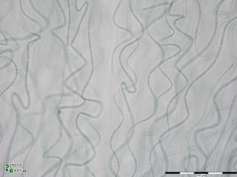 Nostochopsis lobatus