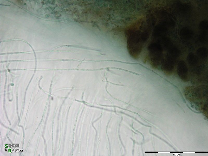 Nostochopsis lobatus