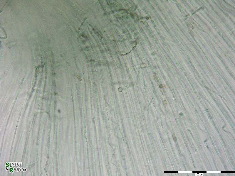 Nostochopsis lobatus