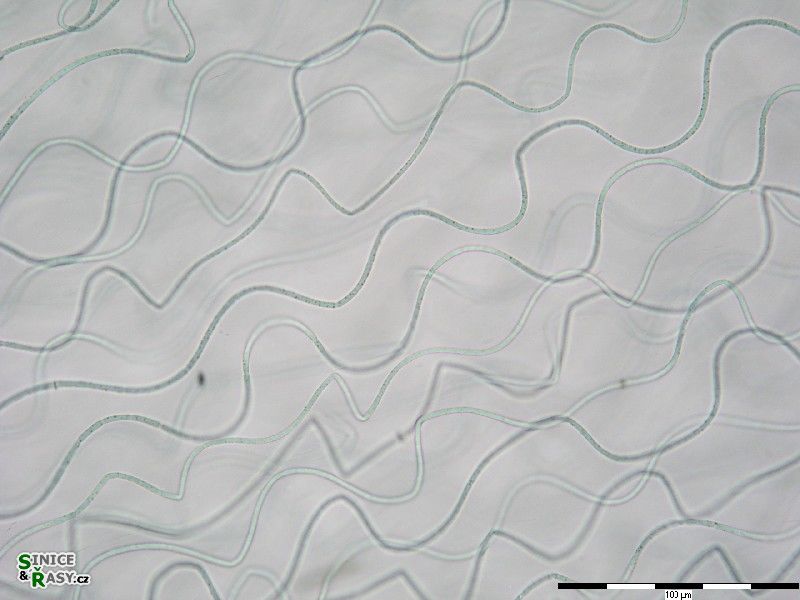 Nostochopsis lobatus