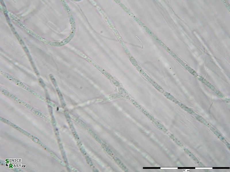 Nostochopsis lobatus